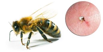 Дел Hondrostrong вклучуваат пчелен отров, кој го подобрува метаболичките процеси во ткивата